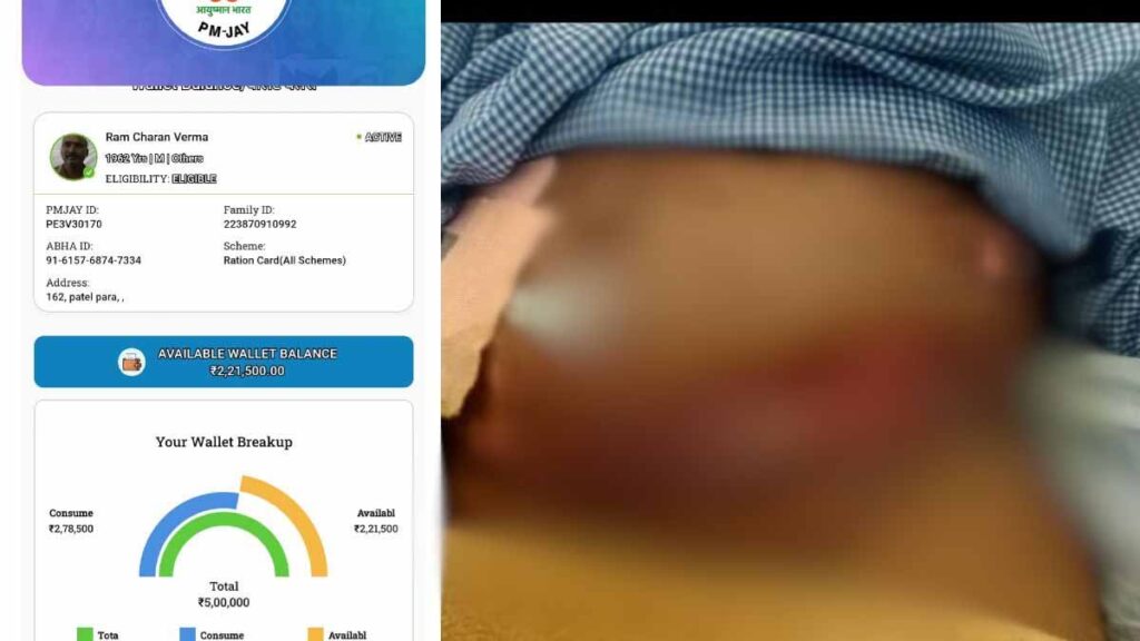 मरीज की जान से खिलवाड़! पेट दर्द की शिकायत पर आयुष्मान कार्ड से 2.71 लाख का इलाज