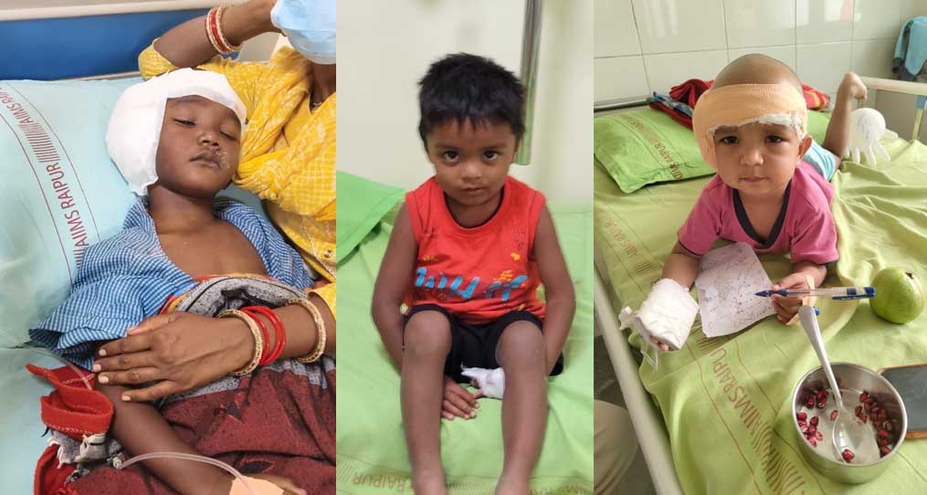 चिरायु’ ने जगाई आस: जन्मजात बधिरता से जूझ रहे 3 बच्चों का सफल कॉक्लियर इंप्लांट