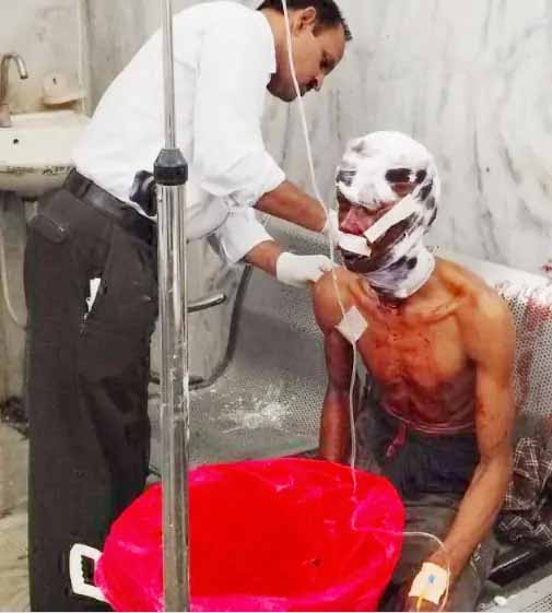 भालू ने किया ग्रामीण पर हमला, उपचार के लिए भेजा गया रायपुर