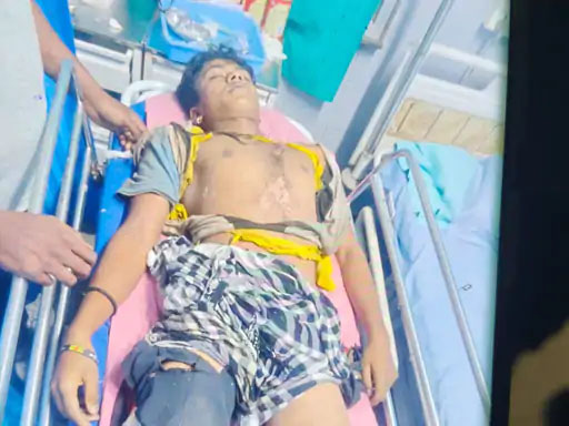 बिजली गिरने से छात्र की मौत: मैदान में क्रिकेट खेलते समय हुआ हादसा