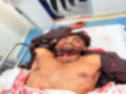 छोटे भाई को बचाने पहुंचे युवक की हत्या: चापड़ से गला काटा, परिवार का थाने पर हंगामा