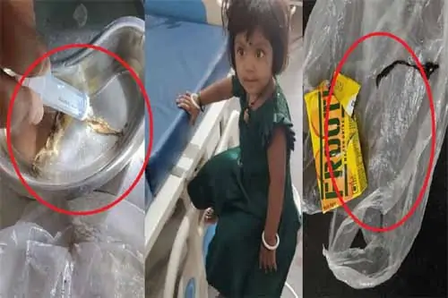 फ्रूटी के 10 रुपये पैकेट में मिली 3 इंच लंबी छिपकली की चमड़ी, दो साल की बच्ची की तबीयत बिगड़ी