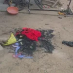 अफेयर के शक में पत्नी को जिंदा जलाने की कोशिश, पेट्रोल डालकर लगाई आग; पति फरार