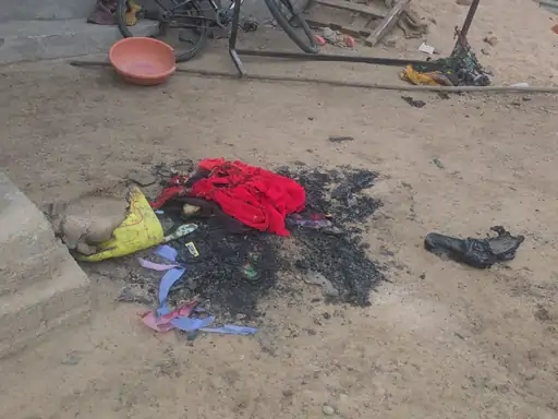 अफेयर के शक में पत्नी को जिंदा जलाने की कोशिश, पेट्रोल डालकर लगाई आग; पति फरार