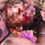 बीजापुर में भालू का हमला, युवक गंभीर घायल; जगदलपुर मेडिकल कॉलेज रेफर