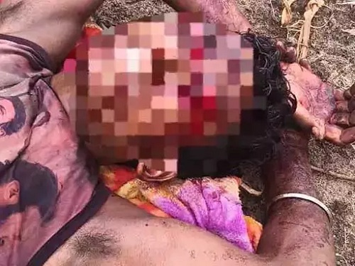 बीजापुर में भालू का हमला, युवक गंभीर घायल; जगदलपुर मेडिकल कॉलेज रेफर