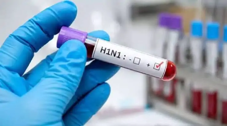 भिलाई की 2 साल 11 माह की बच्ची में मिला एच 1 एन 1 वायरस, इलाज जारी